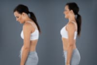 Swayback Posture